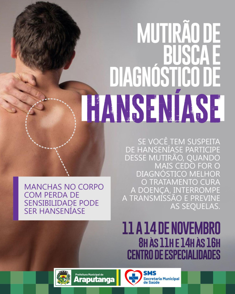 MUTIRÃO DE BUSCA E DIAGNÓSTICO DA HANSENÍASE